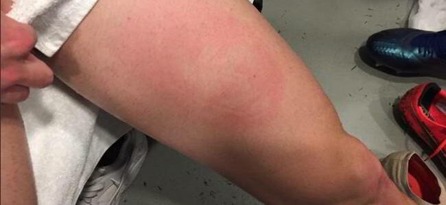 pallonata_fabian_ruiz