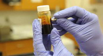 Clorochina contro il coronavirus, il medico francese: “Guarigione in una settimana”