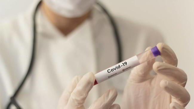 test italiano coronavirus