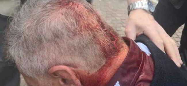 vigile aggredito crispano baby gang