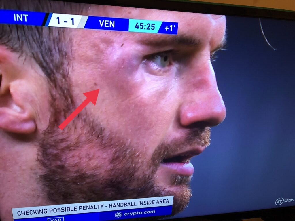 Dzeko-Modolo. Gazzetta in soccorso dell’Inter: “Ecco perché il Var non poteva intervenire”