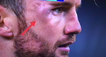 Dzeko-Modolo. Gazzetta in soccorso dell’Inter: “Ecco perché il Var non poteva intervenire”