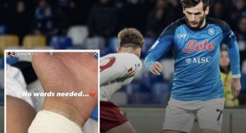 Kvaratskhelia e la morte della nonna: ecco perché indossava quel polsino – FOTO