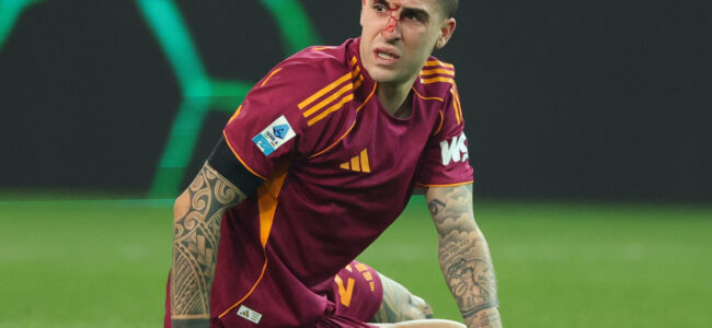 Gianluca-Mancini-bloody-nose.jpg